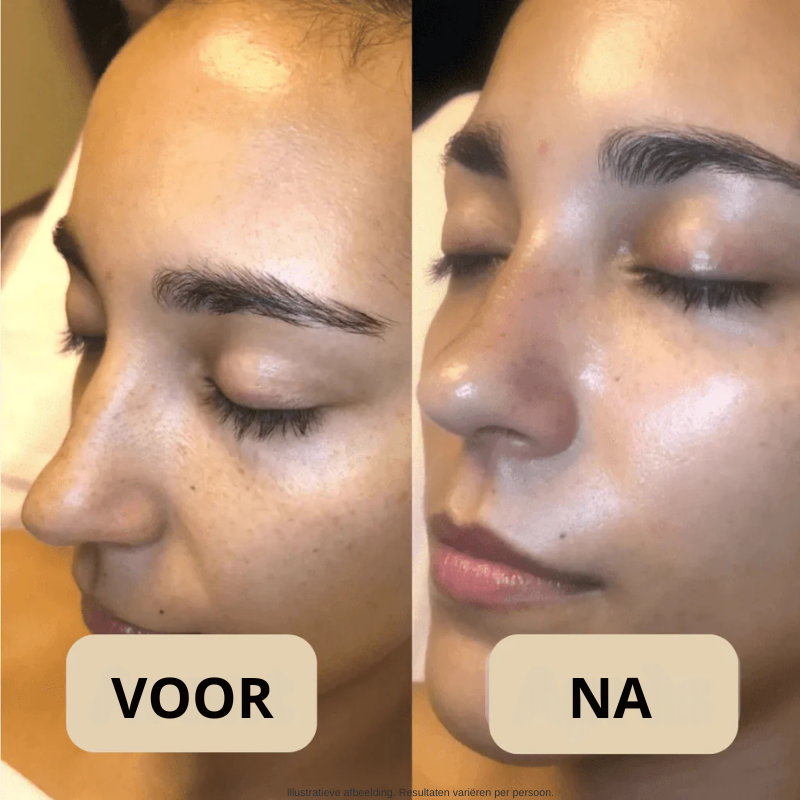 Koreaanse Peel Shot – Onzuiverheden Weg, Stralende Huid
