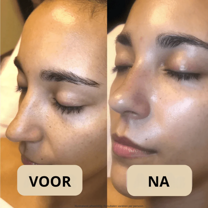 Koreaanse Peel Shot – Onzuiverheden Weg, Stralende Huid