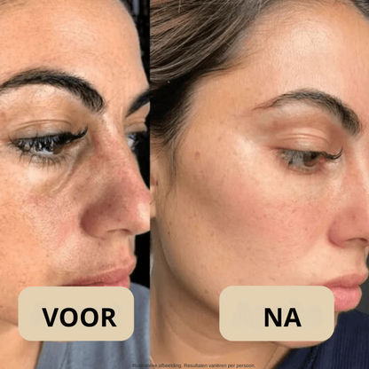 Koreaanse Peel Shot – Onzuiverheden Weg, Stralende Huid