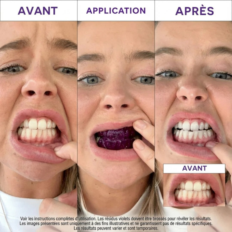 Whitening strips 30 min